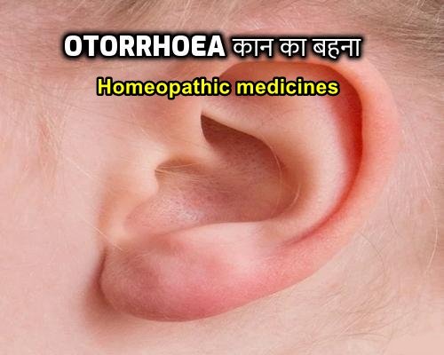 Otorrhoea homeopathic medicine kaan behna ki dawa
