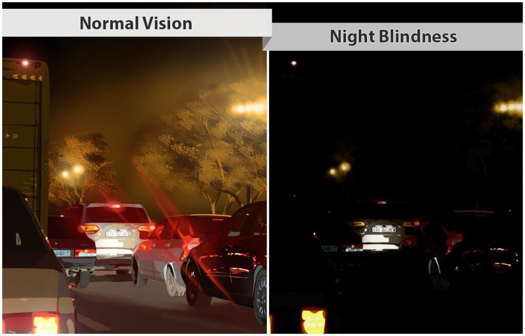 night blindness 1